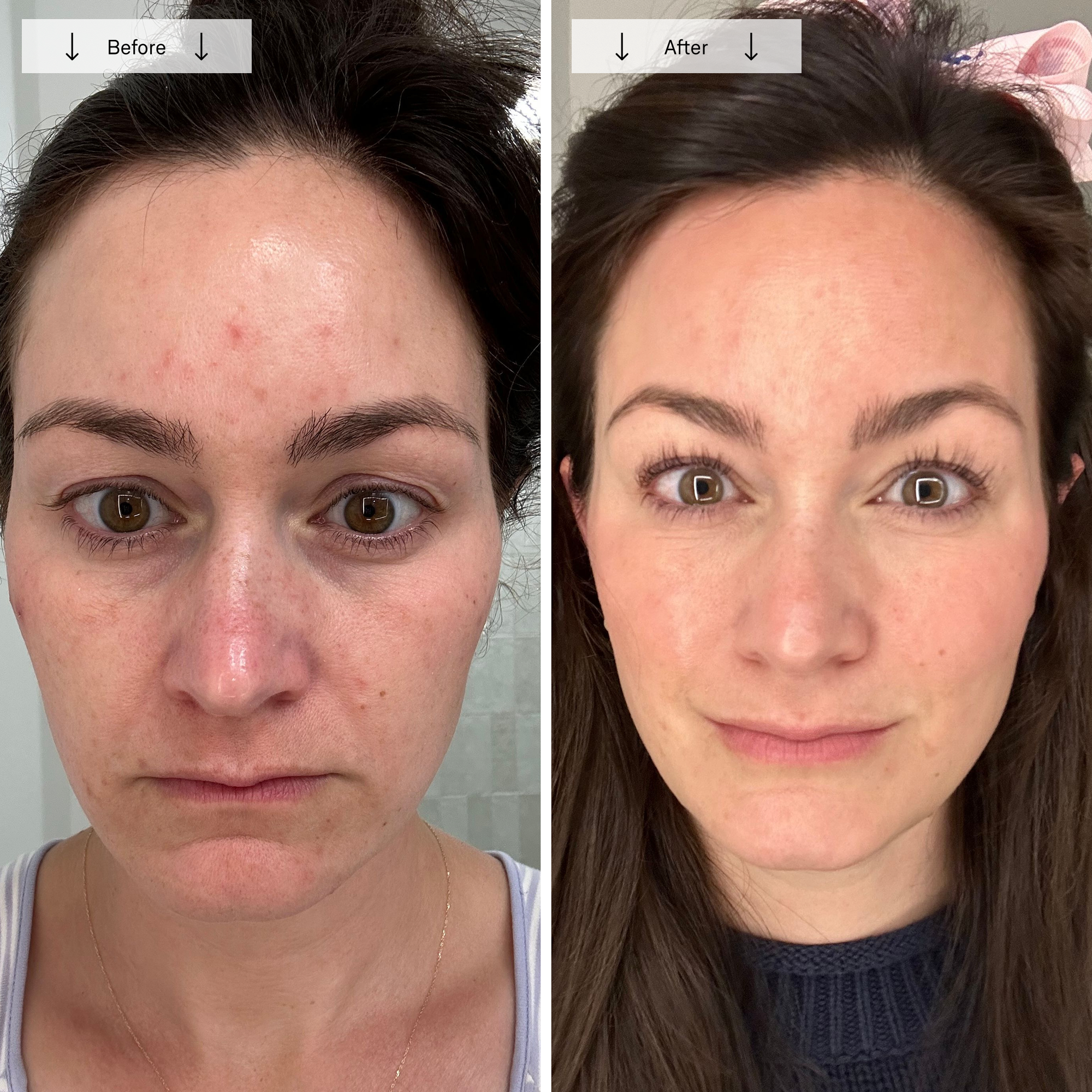 Omnilux Contour Face - Image 10