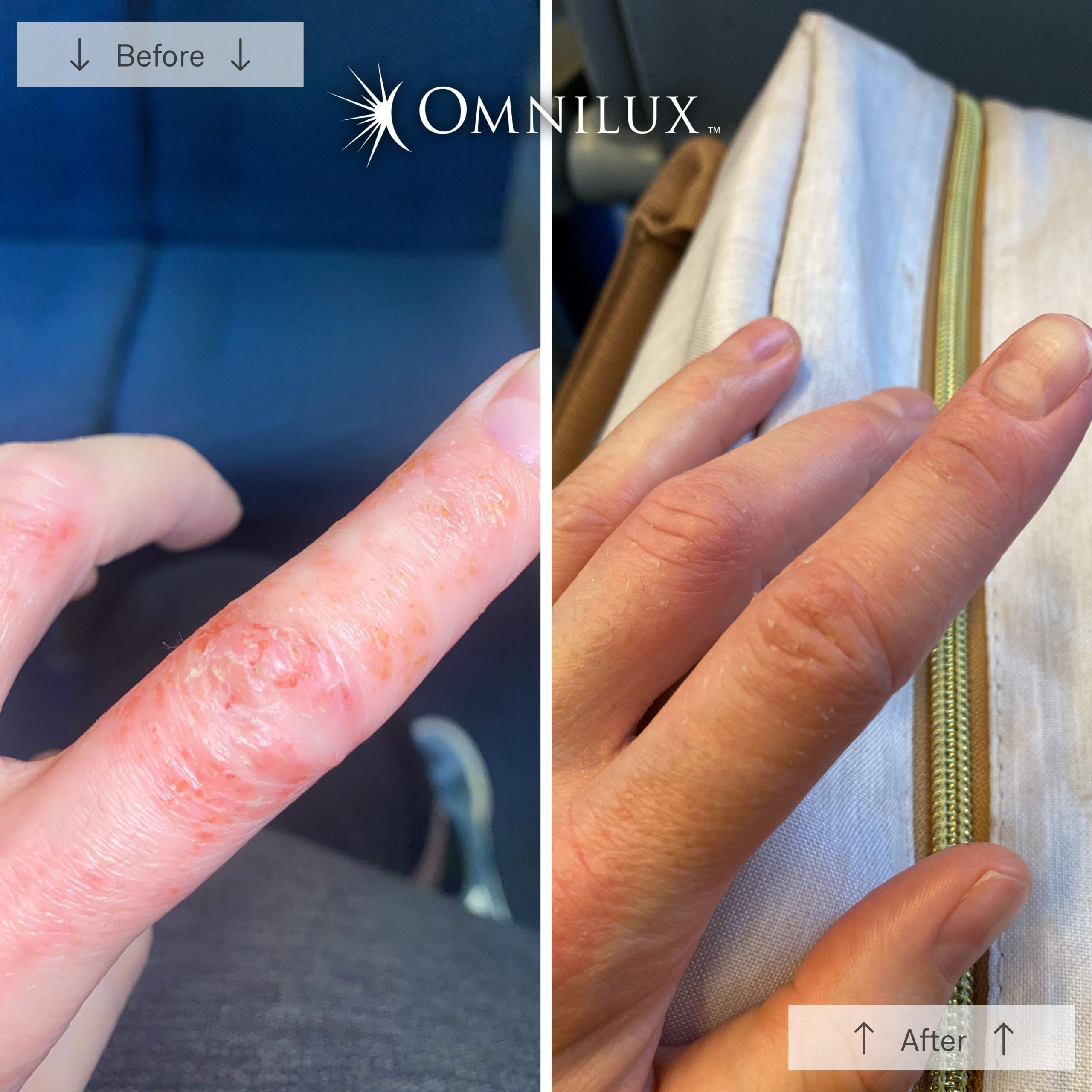 Omnilux Contour Glove - Image 7